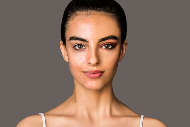 Skin 2
