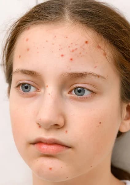 Skin 1